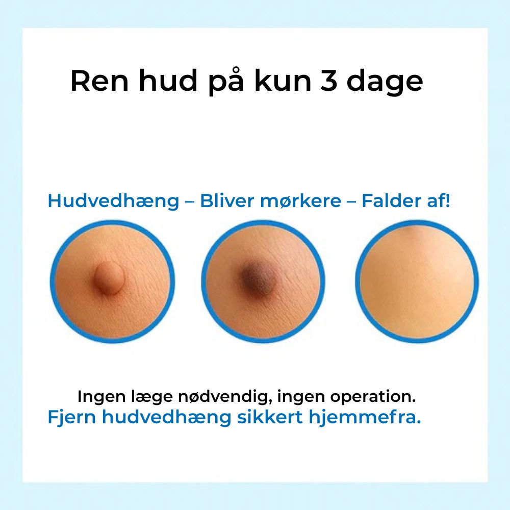 DermSwiftkit™ - Fjern hudmærker nemt derhjemme!