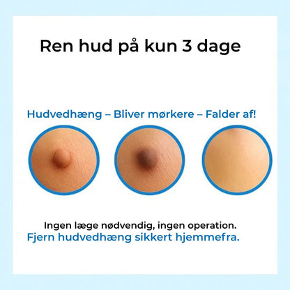 DermSwiftkit™ - Fjern hudmærker nemt derhjemme!